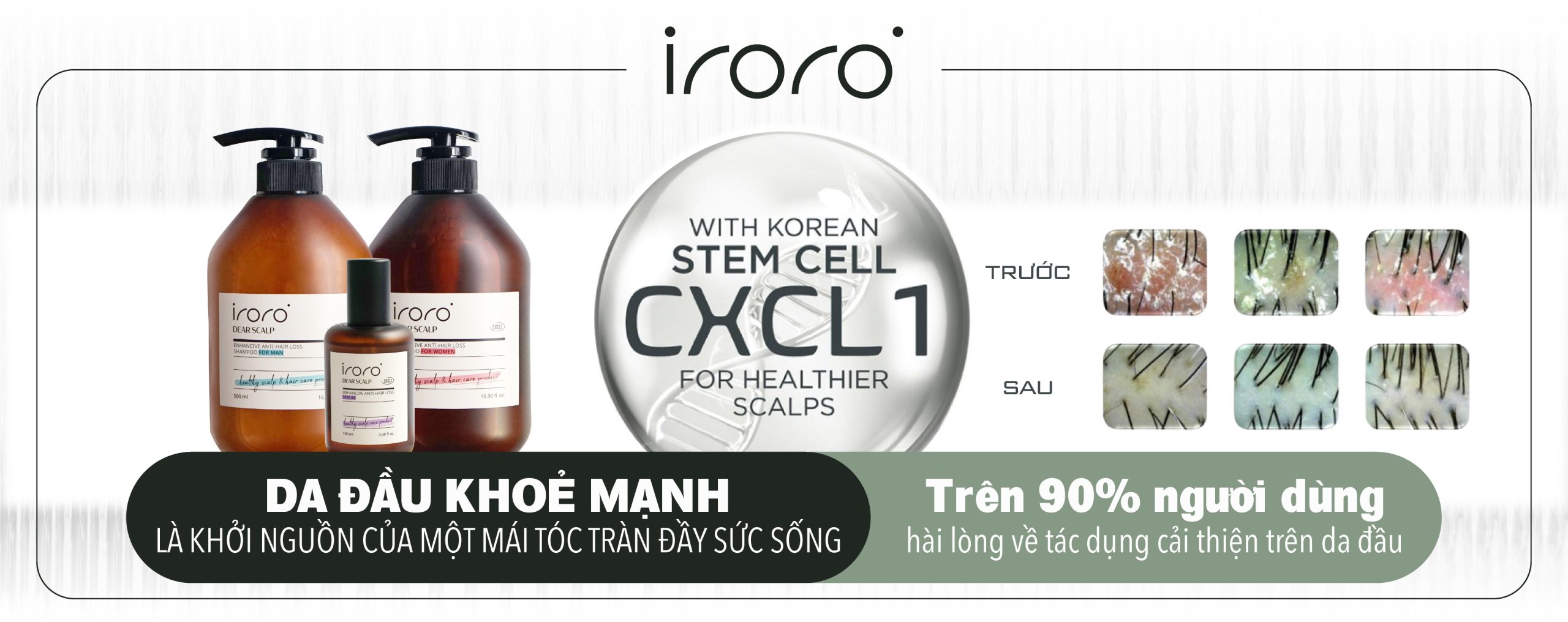IRORO VIETNAM DẦU GỘI, SERUM TRỊ RỤNG TÓC (1)