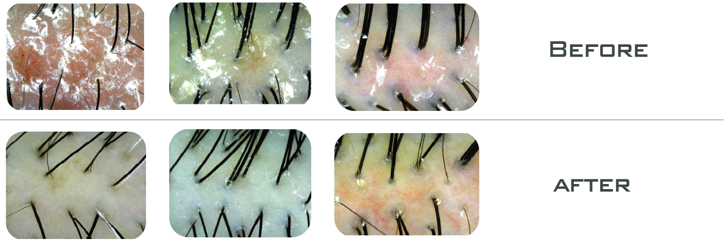 Thử nghiệm CXCL1
